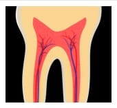 Pulp Therapy for Baby Teeth, primary teeth root canal treatment, 